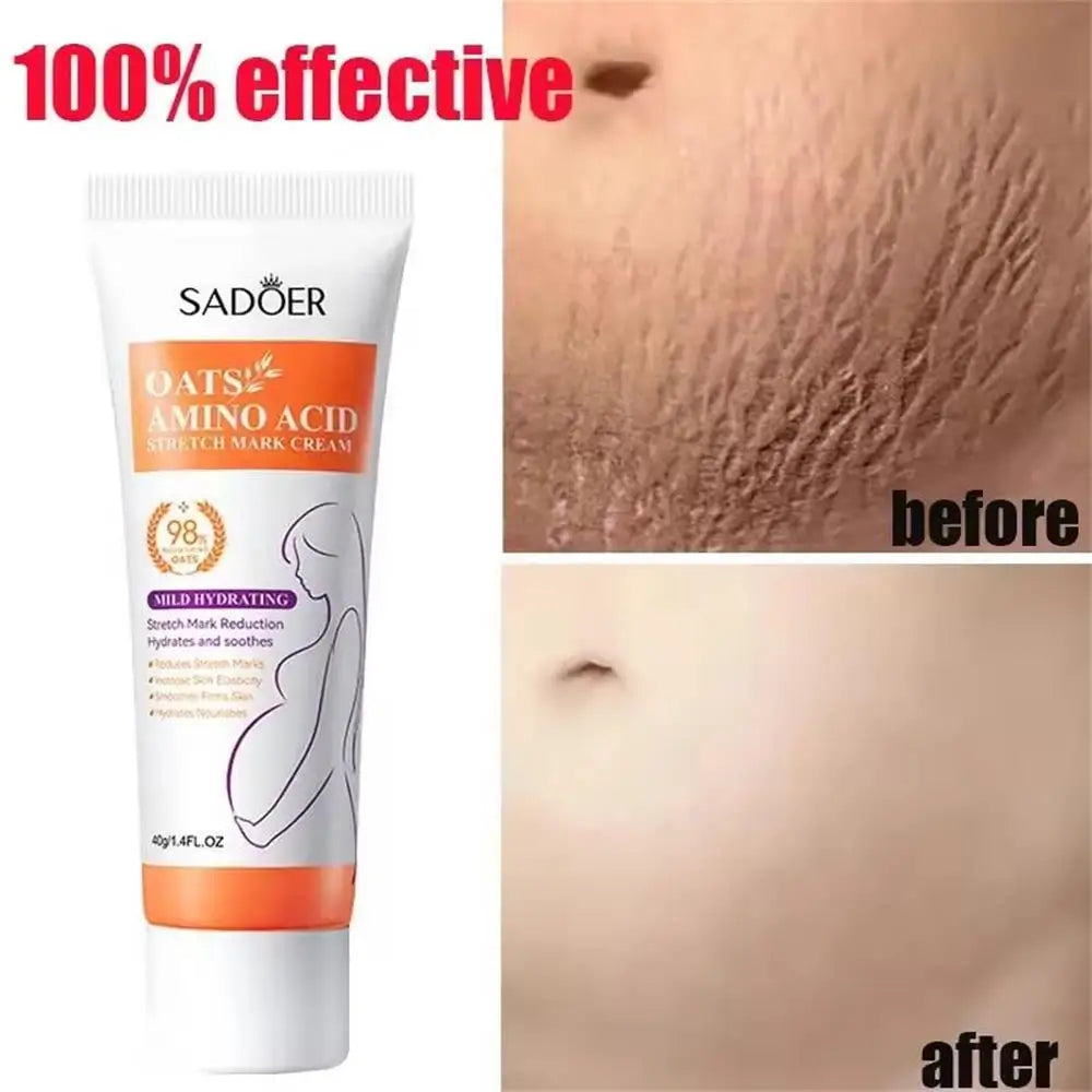 Stretch Mark Removal Oil Removes Postpartum Pregnant Women Scar Repair Obesity Stretch Mark Anti-Aging Firming Serum Skin Care