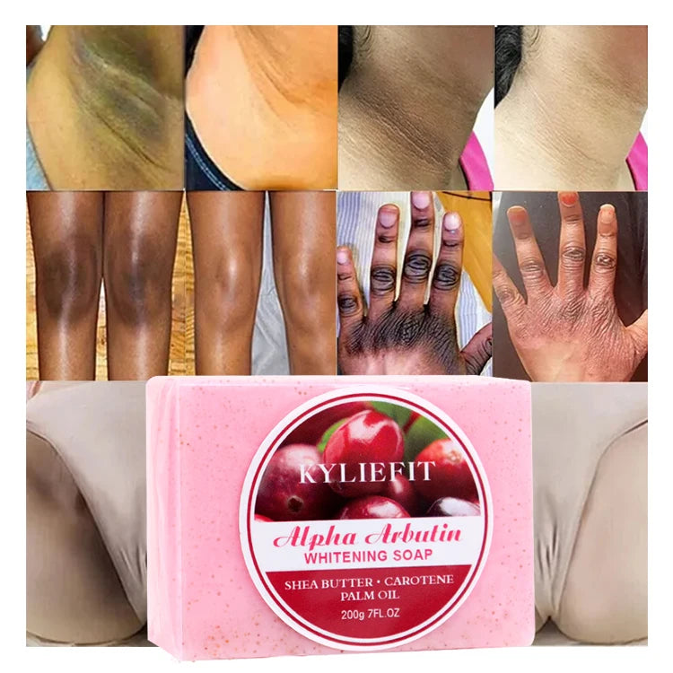 Customized Organic Milk Vitamin C Kojic Acid Coffee Aloe Oil Control Acne Lightening Face Soap for Pimples and Dark Spots