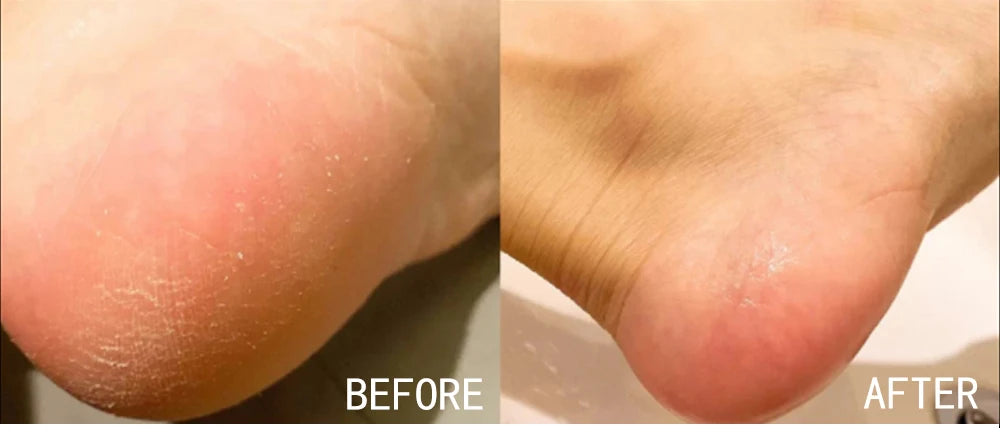 AILKE Vitamin C Cream, Hydration & Brightening Lotion, Improve Dull Skin, Clean Skin, Glowing Beauty Face & Body Care