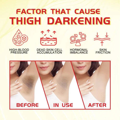 West Month Turmeric Vc Whitening Cream Lighten Dark Acanthoderma Nigricans Moisturizing Whitening Skin Beauty Cream