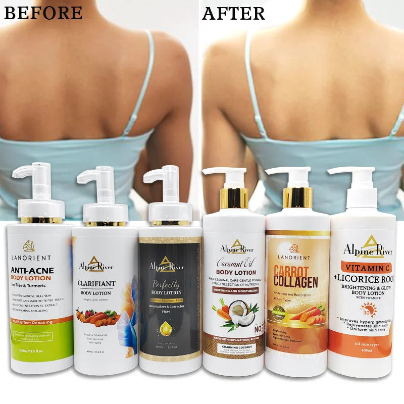 Private Label LANORIENT Natural Organic Turmeric Removing Dark Spots Moisturizing Skin Nourishing Lightening Body Lotion