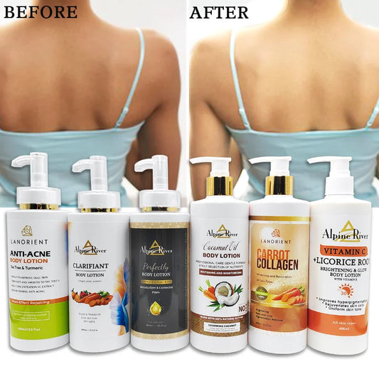 Private Label LANORIENT Natural Organic Turmeric Removing Dark Spots Moisturizing Skin Nourishing Lightening Body Lotion