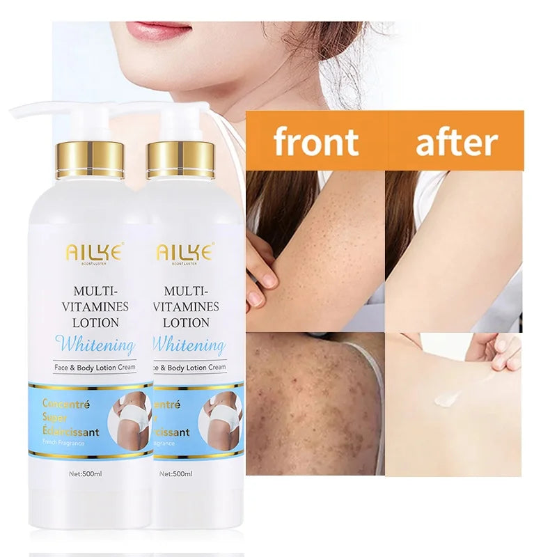 Ailke Milky Niacinamide Knee Elbow  Dark Spot Corrector Women Anti Aging Whitening Body Lotion With Vitamin