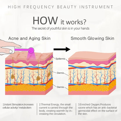 Portable High Frequency Skin Therapy Wand Electrotherapy Comb Tightening Acne Spot Scar Remover Face Massage Aesthetic Equipment