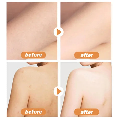 OUHOE Cacao  Lightening Acne Mark Dark Hydrating Whitening Body Lotion