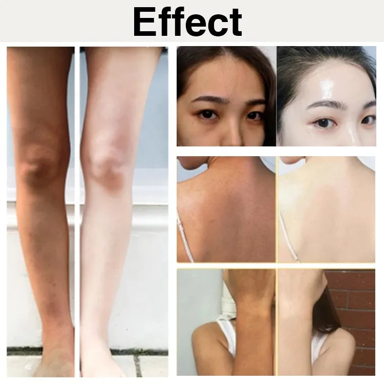 Ailke Forever Beauty Lightening Nature Essence Strong Bleaching Legs Face and Whitening Body Lotion Cream