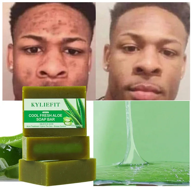 Kyliefit Hand Face Body Soothing Anti Acne Removal Pimples Brightening Lightning Bath Cool Fresh Aloe Vera Soap Bar for All Skin