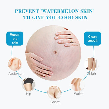 Snail Removes Stretch Mark Cream To Remove Postpartum Obesity Pregnant Women Repair Anti-Aging Anti-Winkles Firming Body Cream