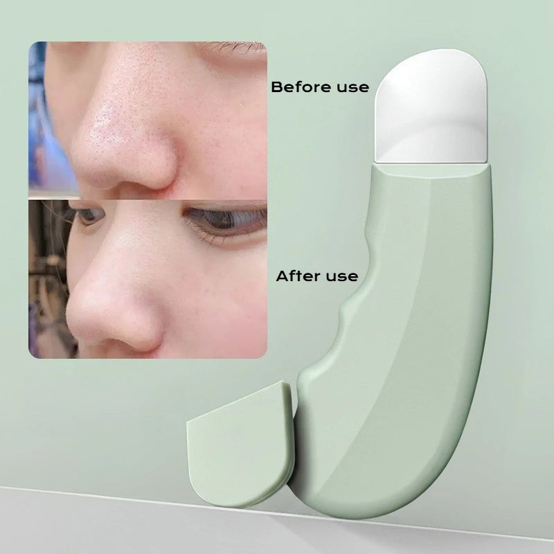 Deep Cleansing Blackhead Whitehead Removal Tool Pore Vacuum Cleaner For Nose Face Rechargeable Skin Care Beauty Travel Kit