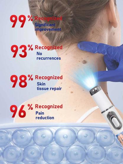 Generation-2 Laser Says Goodbye To all warts In 7 Days