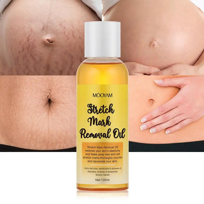 Stretch Mark Removal Oil Removes Postpartum Pregnant Women Scar Repair Obesity Stretch Mark Anti-Aging Firming Serum Skin Care