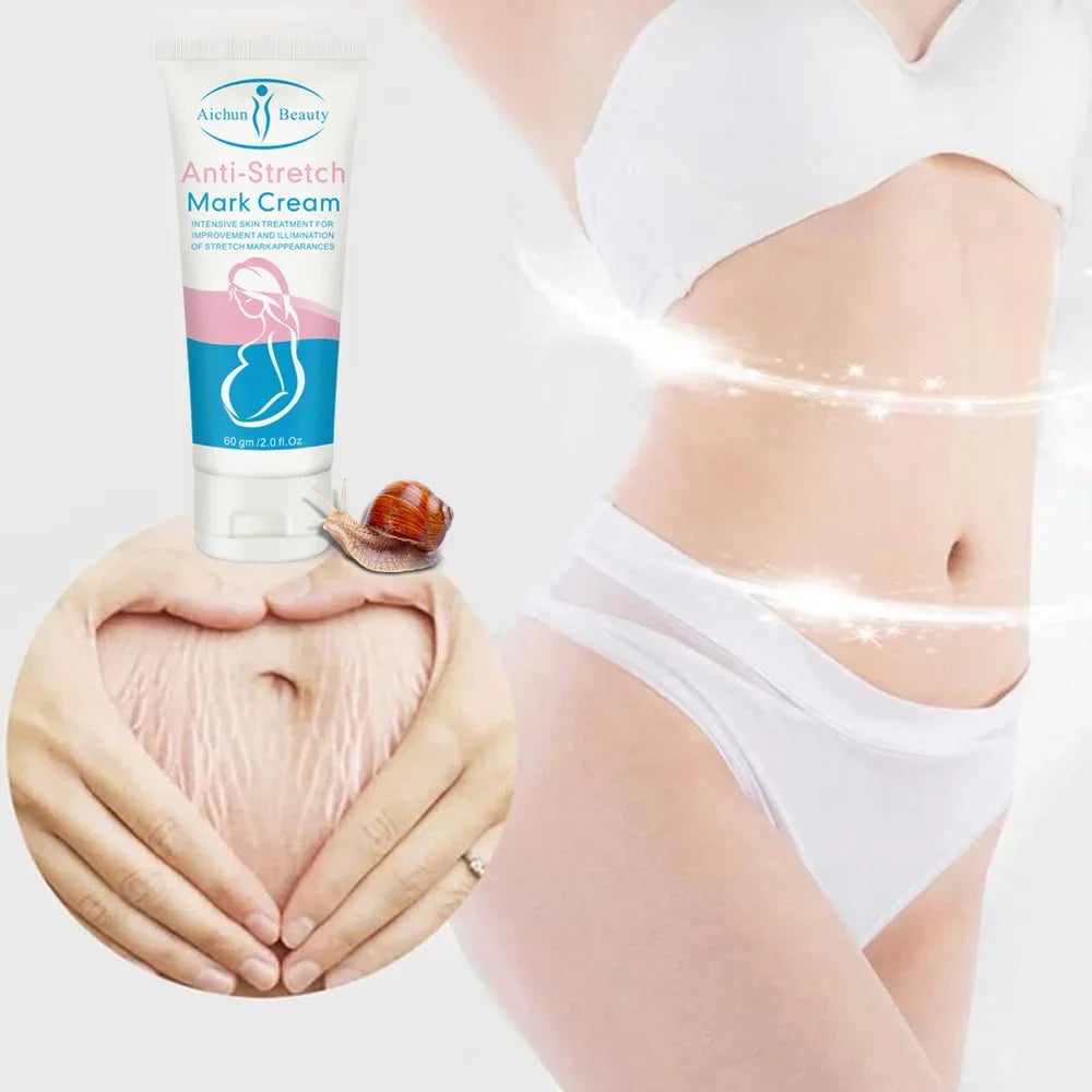 Snail Removes Stretch Mark Cream To Remove Postpartum Obesity Pregnant Women Repair Anti-Aging Anti-Winkles Firming Body Cream