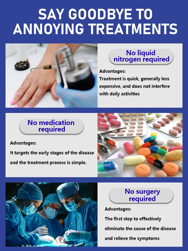 Generation-2 Laser Says Goodbye To all warts In 7 Days