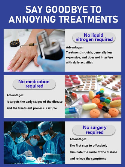 Generation-2 Laser Says Goodbye To all warts In 7 Days