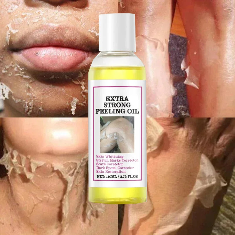 Yellow Peeling Lotion Oil 100% Organic Bleaching Dark Skin Exfoliating Whitening Nourishing Hyaluronic Acid Moisturiz Body Scrub