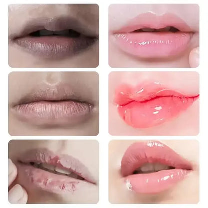 Lip Balm For Remove Dark Lip Melanin Dead Skin Removal Lighten Exfoliate Whitening Moisturizing Nourishing Lip Care