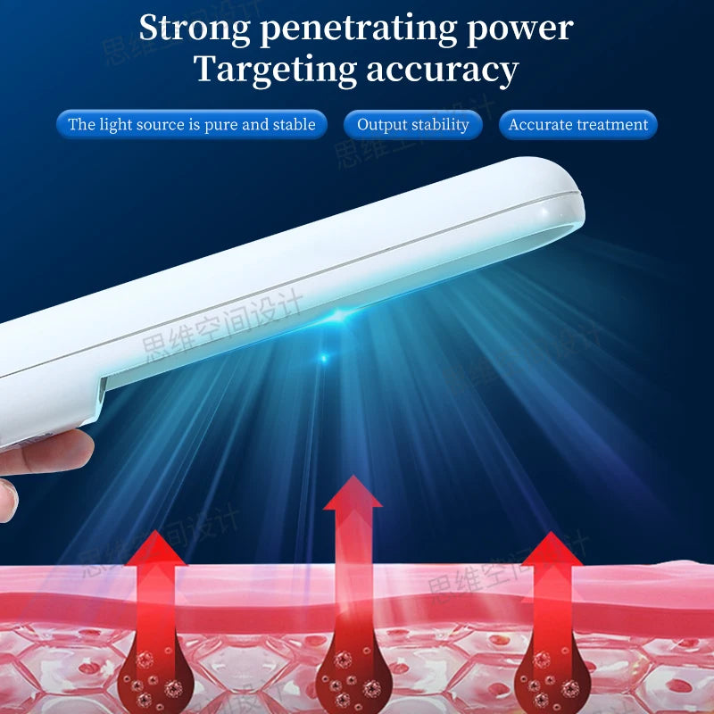 UVB Ultraviolet Phototherapy Instrument Vitiligo Treatment Ultraviolet Lamp Laser Psoriasis Lamp Phototherapy Vitiligo
