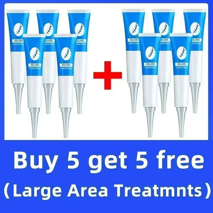 Eliminate Red White Old Stretch Marks Cream For Pregnancy Postpartum Skin Care