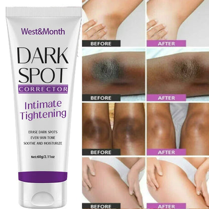 Nicotinamide Brightening Cream For Dark Skin Effective Lighten Thigh Inner Bleach Remove Melanin Private Parts Brighten Cream