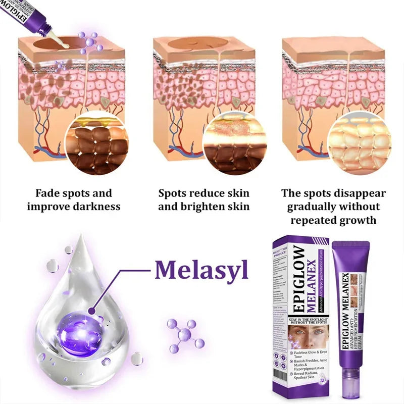 Retinol Whitening Freckle Cream Melasma Dark Spots Pigmentation Removal Fade Stain Melanin Fast Repair Brighten Korean Skin Care
