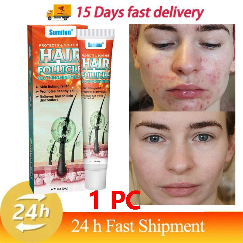 Body Acne Removal Cream Treatment Face Butt Back Acne Marks Smooth Repair Chicken Skin Cream Moisturizing Whitening Skin Care