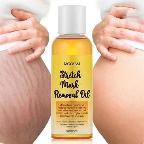 Stretch Mark Removal Oil Removes Postpartum Pregnant Women Scar Repair Obesity Stretch Mark Anti-Aging Firming Serum Skin Care