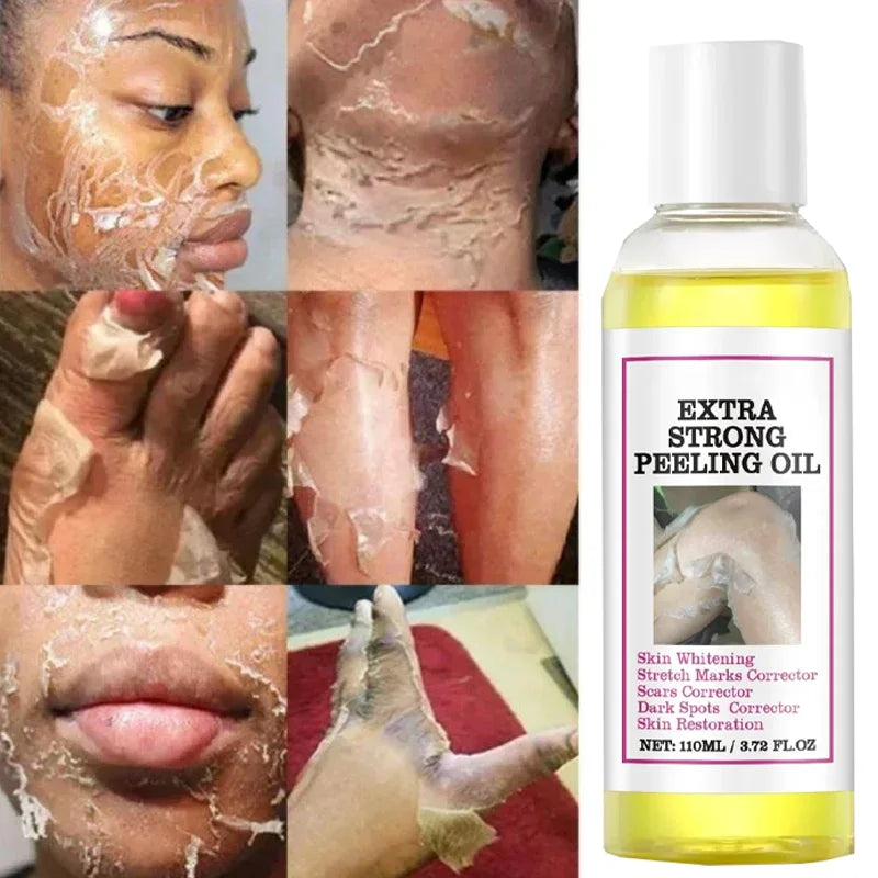 Yellow Peeling Lotion Oil 100% Organic Bleaching Dark Skin Exfoliating Whitening Nourishing Hyaluronic Acid Moisturiz Body Scrub
