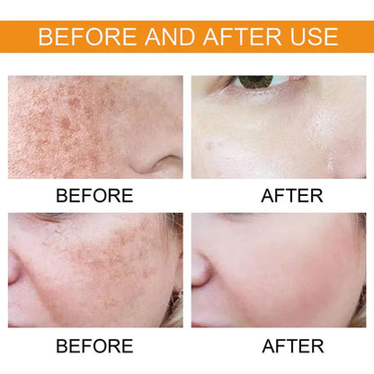 Vitamin C Facial Essence Contains Hyaluronic Acid Dark Spot Remover Moisturizing Repair Anti-aging Serum Skin Care 30ml/10ml