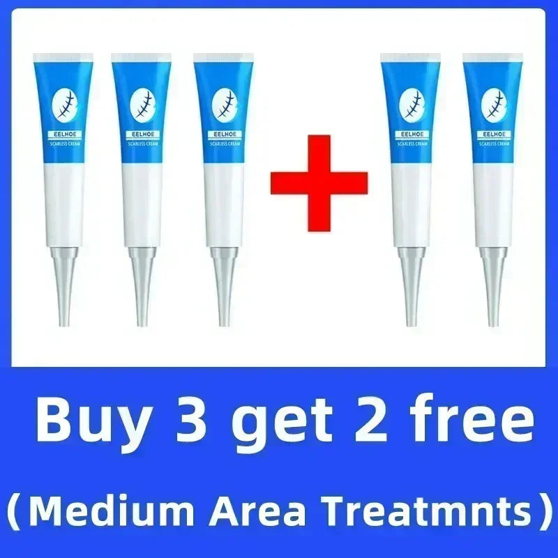 Eliminate Red White Old Stretch Marks Cream For Pregnancy Postpartum Skin Care