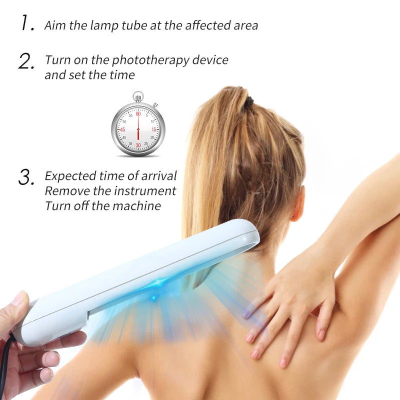 UVB Ultraviolet Phototherapy Instrument Vitiligo Treatment Ultraviolet Lamp Laser Psoriasis Lamp Phototherapy Vitiligo