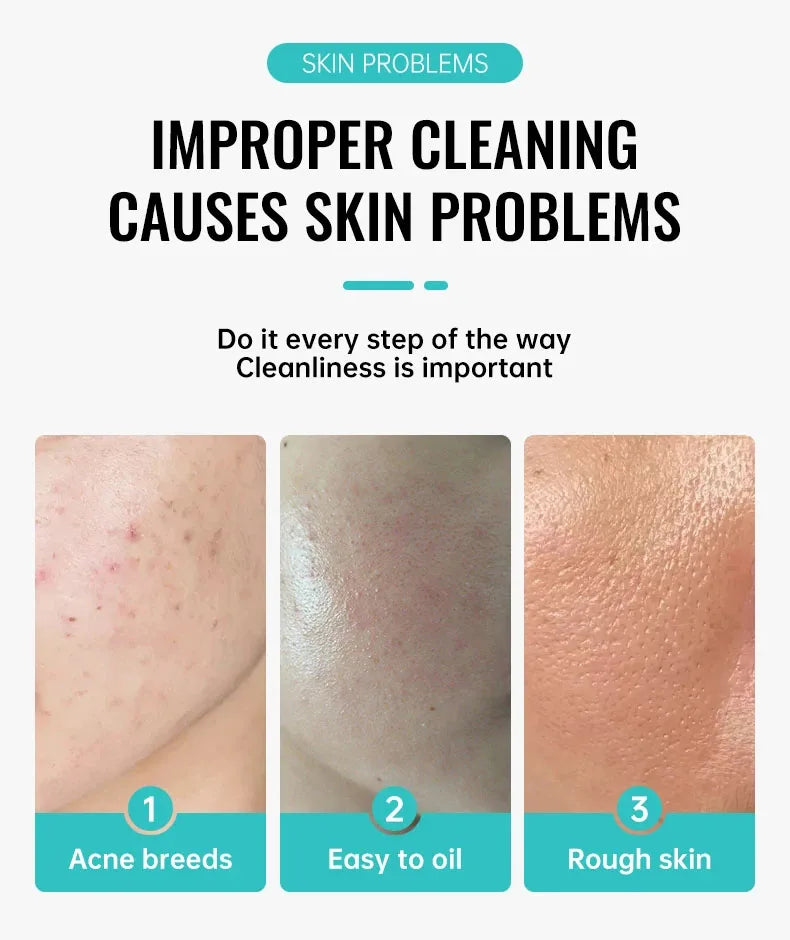 Salicylic Acid Acne Treatment Cream Shrink Pore Remove Blackheads Scars Acne Marks Spots Oil Control Whitening Korean Skin Care