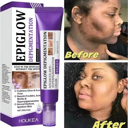 Retinol Whitening Freckle Cream Melasma Dark Spots Pigmentation Removal Fade Stain Melanin Fast Repair Brighten Korean Skin Care