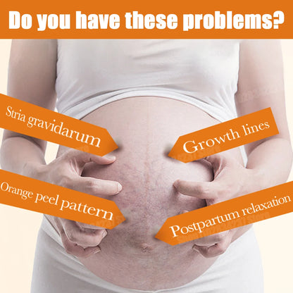 Stretch Marks Removal Cream Light Lines Postpartum Obesity Pregnancy Powerful Fast Absorption