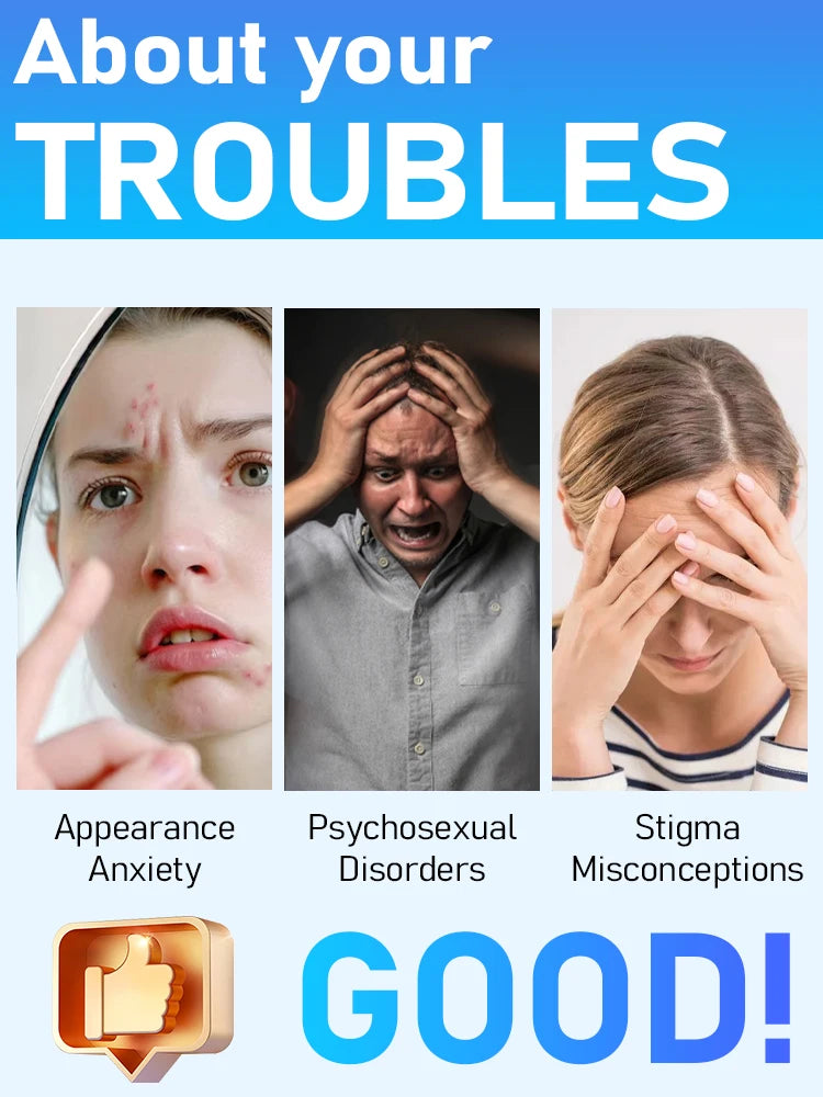 Generation-2 Laser Says Goodbye To all warts In 7 Days