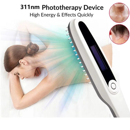 311nm UVB Phototherapy Lamp Recommended by Dermatologists for Skin Treatment