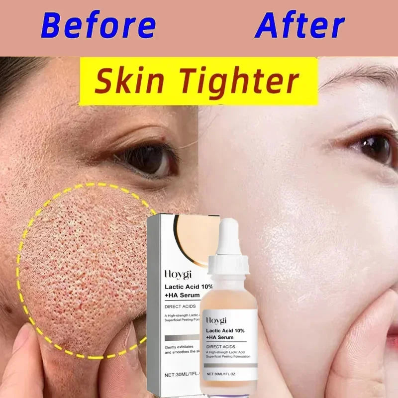 Lactic Acid Shrink Pores Serum Fast Large Pores Removal Firming Skin Essence Firming Smoothing Nourishing Repair Face Skin Care