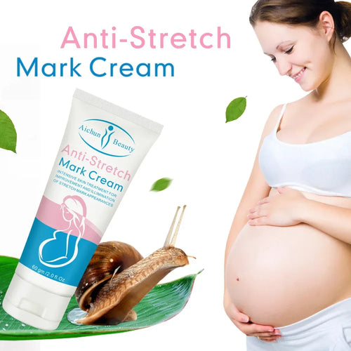 Snail Removes Stretch Mark Cream To Remove Postpartum Obesity Pregnant Women Repair Anti-Aging Anti-Winkles Firming Body Cream