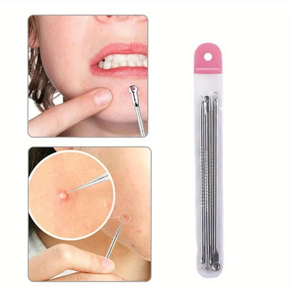 Blackhead Acne Pimple Blemish Extractor Remover Kit Stainless Steel Needles Remove Tools Face Skin Care Pore Cleaner 4pcs/bag