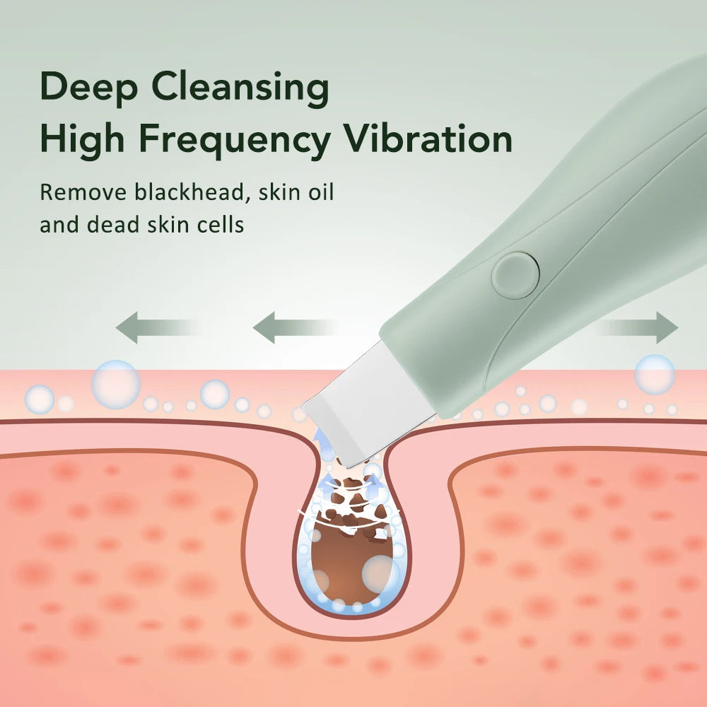 Skin Scrubber High Frequency Vibration Deep Clean Facial Tool Blackhead Pore Remover Face Shovel Beauty Care Exfoliator Device