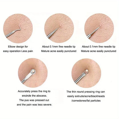 Blackhead Acne Pimple Blemish Extractor Remover Kit Stainless Steel Needles Remove Tools Face Skin Care Pore Cleaner 4pcs/bag