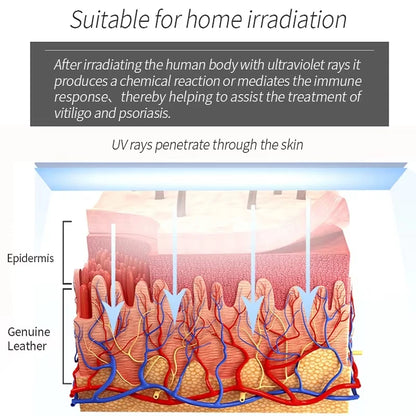 311nm UVB Phototherapy Lamp Recommended by Dermatologists for Skin Treatment