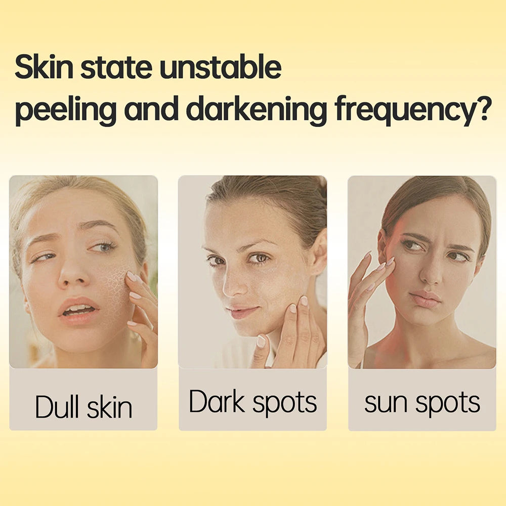 Kojic Acid Retinol Cream Skin Whitening Cream Remove Dark Spots Anti Aging Brighten Moisturizing Nourishing Facial Skin Care