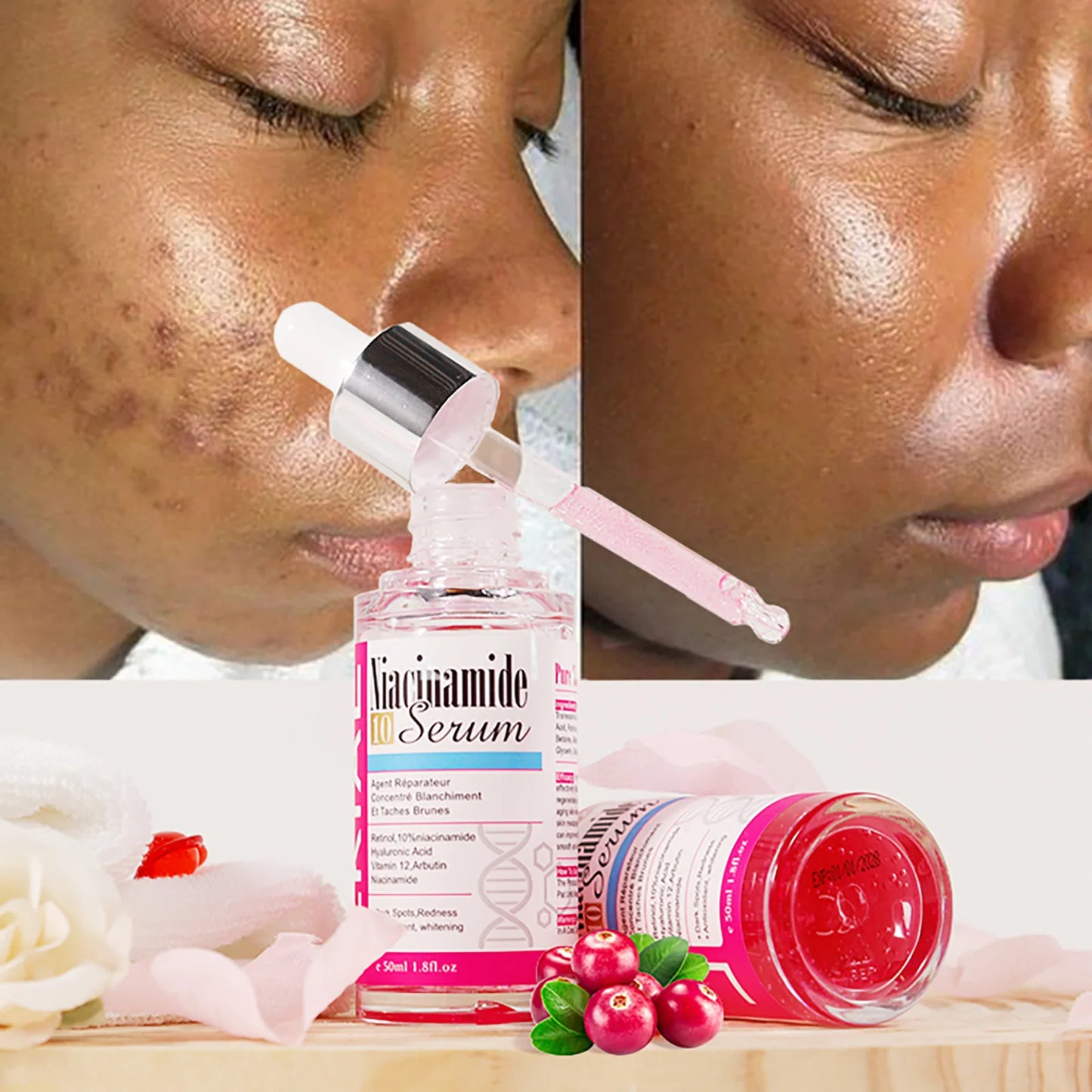 LKIAE Nicotinamide Whitening Essence, Anti-Aging, Reduce Freckles, With Hyaluronic Acid, Moisturizing Serum For Face And Body