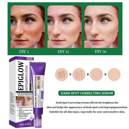 Retinol Whitening Freckle Cream Melasma Dark Spots Pigmentation Removal Fade Stain Melanin Fast Repair Brighten Korean Skin Care