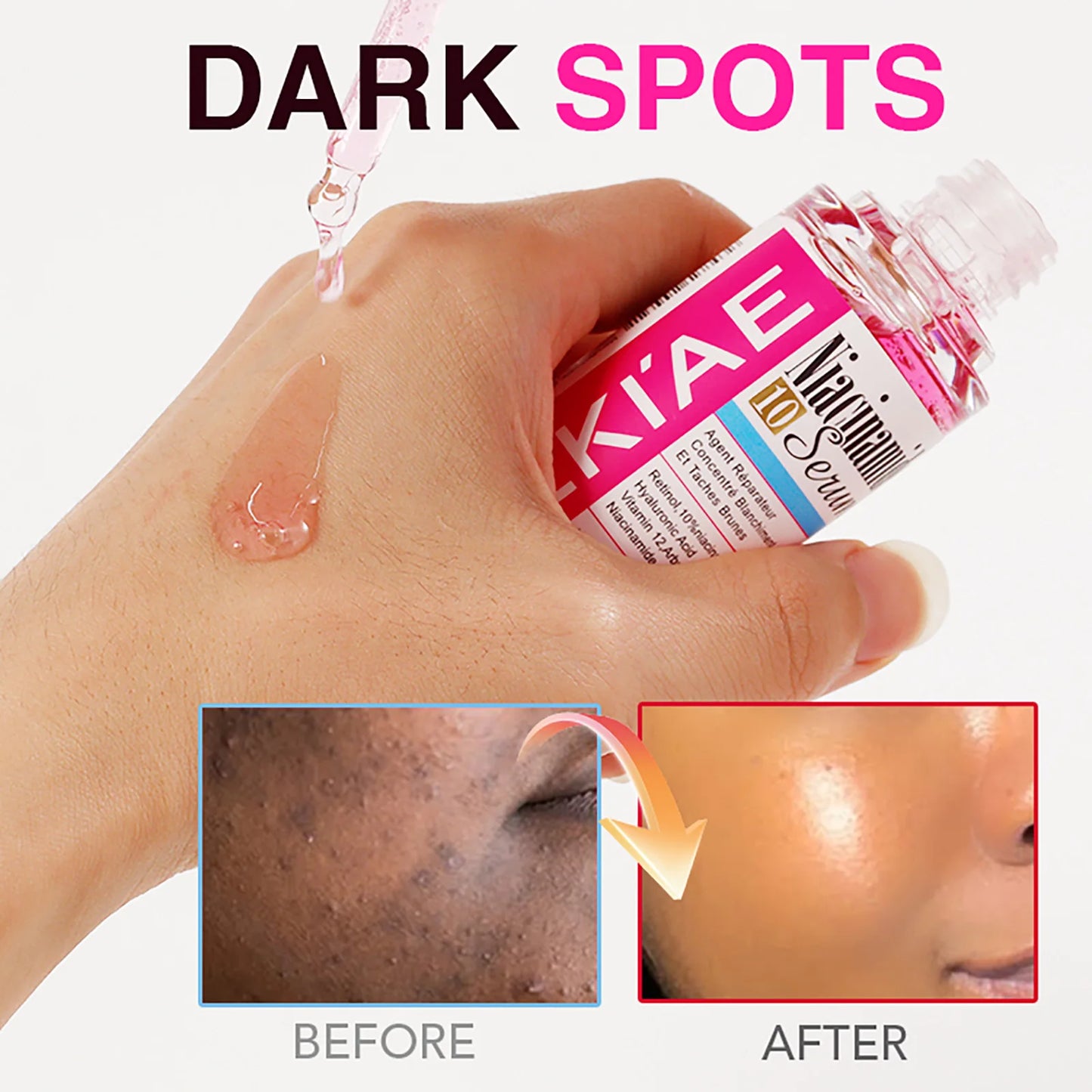 LKIAE Nicotinamide Whitening Essence, Anti-Aging, Reduce Freckles, With Hyaluronic Acid, Moisturizing Serum For Face And Body