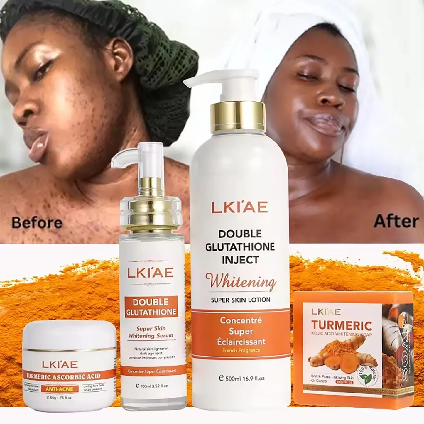 AILKE Lightening and Acne Removal Skin Care Range, With Double Glutathione, Vitamin C, Hydrating, Smooth Skin, Even Skin Tone