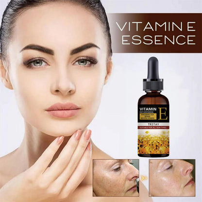 vitamin e anti wrinkle formula supreme care essence moisturizes, reduces fine lines and wrinkles, and increases skin elasticity