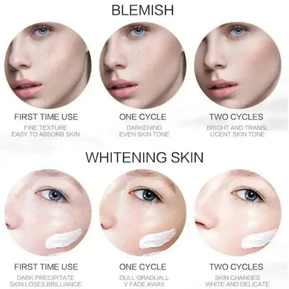 1/3/5pcs Whitening Freckle Cream Niacinamide Remove Dark Spot Cream Anti Freckle and Aging Cream Fade Pigmentation Melasma Skin