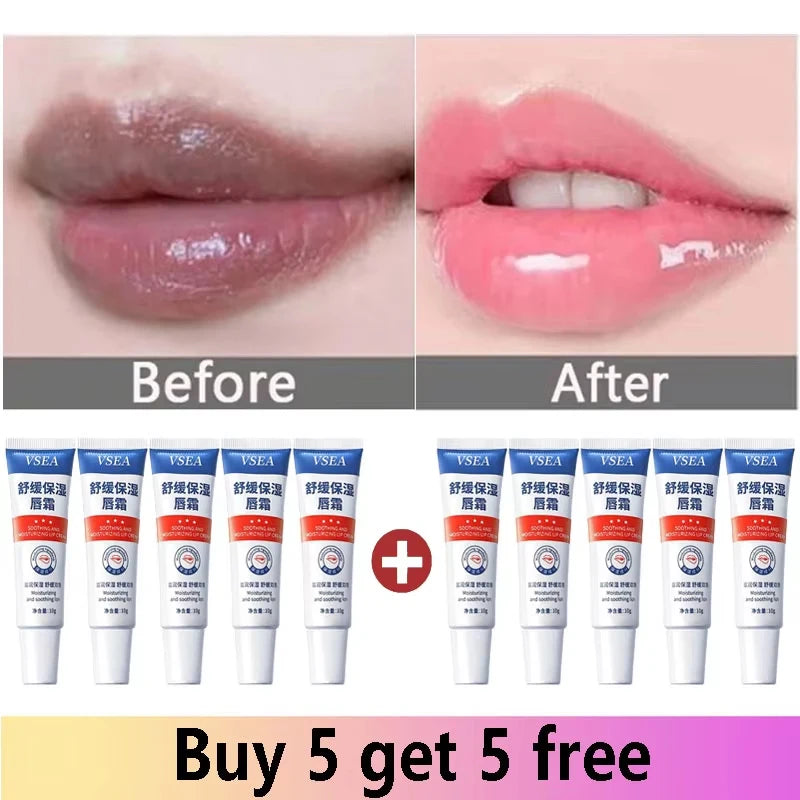 Remove Dark Lip Balm Fast Lightening Pink Lip Exfoliating Fade Lip Line Dead Skin Moisturizer Korean Care Products Beauty Health