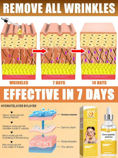 For Wrinkles Free, Instantly Wrinkles Ageless